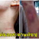 สาวผู้อาศัยในเกาหลี โดนสาวเกาหลีรุมทำร้ายอย่างไร้ความปราณี เพียงแค่ขอทิชชู่!! - WORLD OF BUZZ