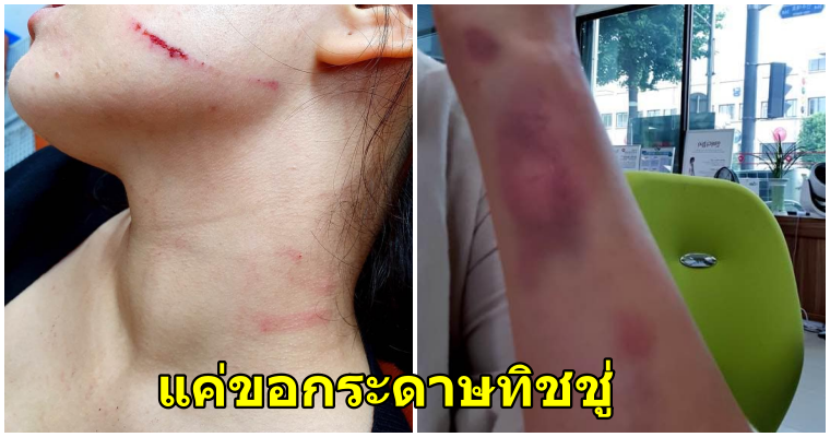สาวผู้อาศัยในเกาหลี โดนสาวเกาหลีรุมทำร้ายอย่างไร้ความปราณี เพียงแค่ขอทิชชู่!! - WORLD OF BUZZ