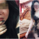 สาวสวยถูกสามีซ้อมเพราะโพสต์รูปวาบหวิวลงเฟชบุ๊ค - WORLD OF BUZZ