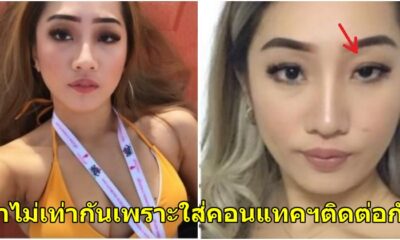 อุทาหรณ์เตือนใจ! สาวแชร์ประสบการณ์คนที่ชอบใส่คอนแทคเลนส์ตลอดเวลา - WORLD OF BUZZ 1