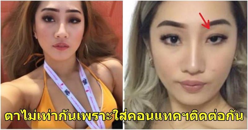 อุทาหรณ์เตือนใจ! สาวแชร์ประสบการณ์คนที่ชอบใส่คอนแทคเลนส์ตลอดเวลา - WORLD OF BUZZ 1