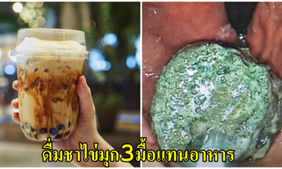 หนุ่มวัย 20 ปวดท้องสาหัส หมอผ่าเจอก้อนแป้งอุดตันลำไส้ หลังดื่มชาไข่มุกทุกวัน แทนอาหาร3มื้อ - WORLD OF BUZZ