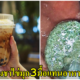 หนุ่มวัย 20 ปวดท้องสาหัส หมอผ่าเจอก้อนแป้งอุดตันลำไส้ หลังดื่มชาไข่มุกทุกวัน แทนอาหาร3มื้อ - WORLD OF BUZZ