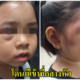 แม่เตรียมเอาผิด ครูใช้ไม้ตีหัวนักเรียนจนตามีอาการช้ำเลือด เพียงเพราะบวกเลขช้า - WORLD OF BUZZ 5