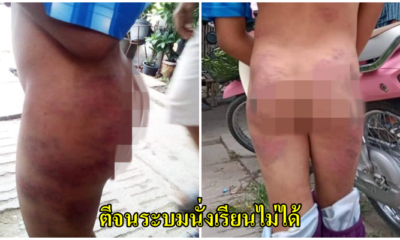 ชาวเน็ตกระหน่ำด่าครูลงโทษโหด นักเรียนไม่ทำการบ้าน ใช้ไม้ดาบตีก้นจนช้ำระบมนั่งไม่ได้ ต้องยืนเรียน - WORLD OF BUZZ