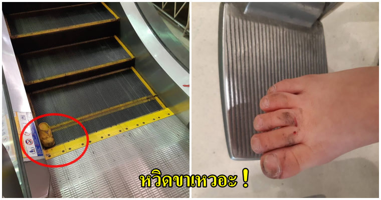 คุณพ่อเตือนภัย! ห้ามเด็กๆใส่รองเท้ายางแบบนี้ขึ้นบันไดเลื่อนเด็ดขาด หลังลูกน้อยขาหวิดเหวอะ - WORLD OF BUZZ