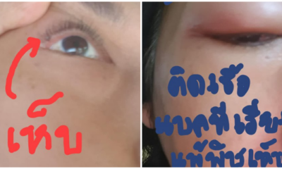 สาวเตือนภัย! “เห็บสุนัข” เกาะเปลือกตา แพ้พิษจนตาอักเสบ-เป็นหนอง - WORLD OF BUZZ