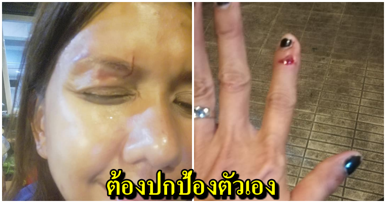 สาวโพตส์ ข้างบ้านเมายา บุกทำร้ายหลายครั้ง แจ้งตำรวจก็ไม่คืบหน้า จนต้องปกป้องตัวเอง - WORLD OF BUZZ