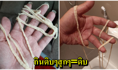 อวสานข้าวเที่ยง พยาธิตัวตืดยาวเฟื้อยหลุดจากก้น ยังกระดึ๊บให้เห็นกันตัวเป็นๆ - WORLD OF BUZZ 1