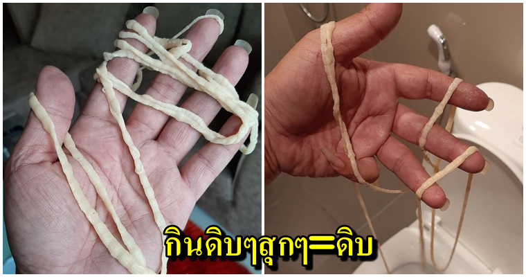 อวสานข้าวเที่ยง พยาธิตัวตืดยาวเฟื้อยหลุดจากก้น ยังกระดึ๊บให้เห็นกันตัวเป็นๆ - WORLD OF BUZZ 1