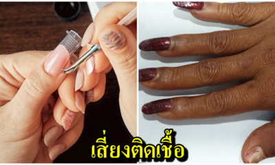 อุทาหรณ์เตือนสาวชอบทำเล็บ ติดเชื้อที่นิ้วลามเข้ากระดูก เครื่องมือไม่สะอาด เสี่ยงพิการ-ติดเชื้อHIV - WORLD OF BUZZ 5