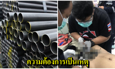 อุทาหรณ์หนุ่มวัย 21 อุตริใช้ท่อเหล็กช่วยตัวเอง อวัยวะเพศติด 5 วัน สุดท้ายเน่าจนต้องตัดทิ้ง! - WORLD OF BUZZ