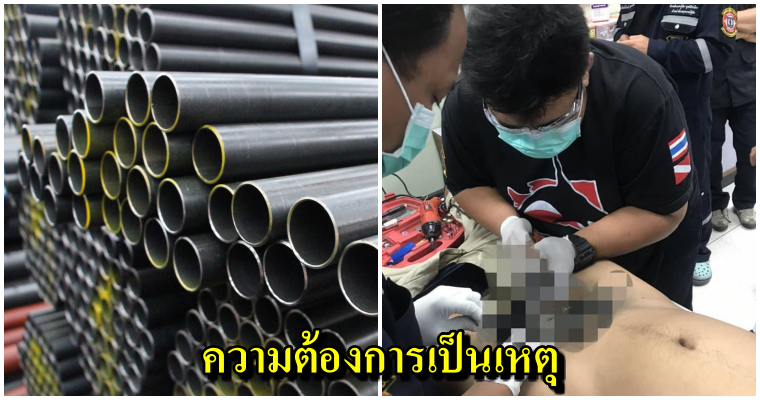 อุทาหรณ์หนุ่มวัย 21 อุตริใช้ท่อเหล็กช่วยตัวเอง อวัยวะเพศติด 5 วัน สุดท้ายเน่าจนต้องตัดทิ้ง! - WORLD OF BUZZ