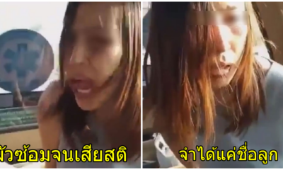 สุดเวทนา..สาวแม่ลูกอ่อน โดนผัวซ้อมจนเสียสติ จำอะไรไม่ได้ จำได้แต่ชื่อลูก - WORLD OF BUZZ