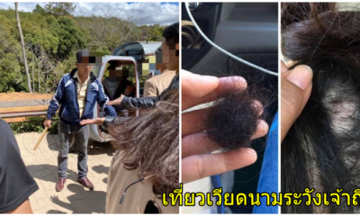 หนุ่มไทยโพตส์เตือนอุทาหรณ์ ไปเวียดนาม เจอเจ้าถิ่นแซงคิว-จิกหัวตบ ผมหลุดเป็นกระจุก - WORLD OF BUZZ