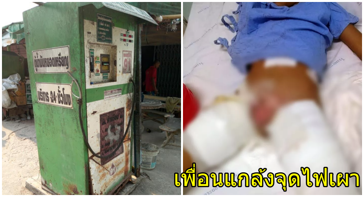 เด็ก ป.2 กดน้ำมันจากตู้หยอดเหรียญ ราดเพื่อนรุ่นพี่ ป.3 จุดไฟเผาอวัยวะเพศไหม้เกรียม ส่อเป็นหมันตลอดชีวิต - WORLD OF BUZZ 1