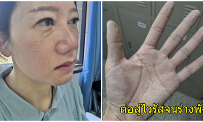 เปิดภาพ รอยแผลบนใบหน้าและฝ่ามือของหมอ-พยาบาล ตรากตรำสู้ไวรัสโคโรนา จนร่างพัง ยังยืนหยัดเพื่อผู้ป่วย - WORLD OF BUZZ