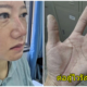 เปิดภาพ รอยแผลบนใบหน้าและฝ่ามือของหมอ-พยาบาล ตรากตรำสู้ไวรัสโคโรนา จนร่างพัง ยังยืนหยัดเพื่อผู้ป่วย - WORLD OF BUZZ