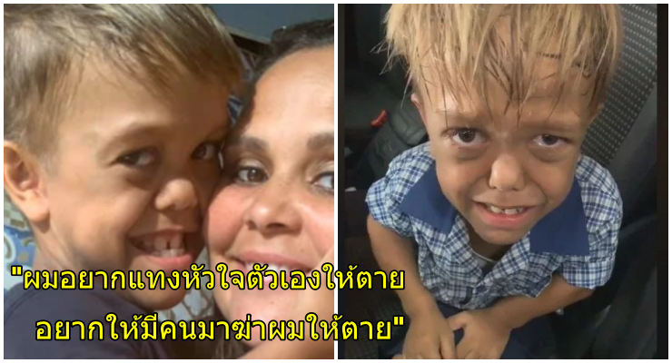 แม่ไลฟ์ทั้งน้ำตา ลูก 9 ขวบขอให้ฆ่าให้ตาย หลังโดนเพื่อนล้อหนักเพราะภาวะแคระ - WORLD OF BUZZ