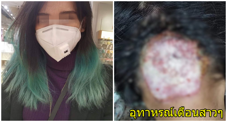 สาวเปิดใจ ถูกช่างทำผมกัดสีผมจนหัวเหวอะ คิดเงิน 1 พัน ก่อนโอนเงินคืนแล้วปิดร้านหนี - WORLD OF BUZZ