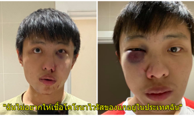 สุดสลด นศ.สิงคโปร์ถูกวัยรุ่นอังกฤษทำร้ายร่างกายเพราะเป็นคนเอเชีย และกรณีไวรัสโควิด-19 - WORLD OF BUZZ