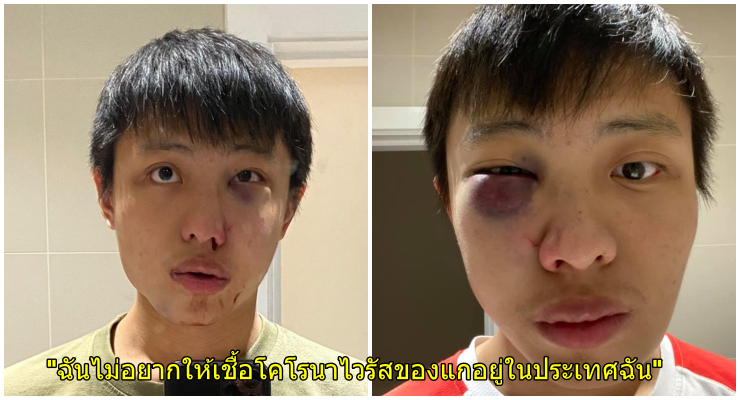 สุดสลด นศ.สิงคโปร์ถูกวัยรุ่นอังกฤษทำร้ายร่างกายเพราะเป็นคนเอเชีย และกรณีไวรัสโควิด-19 - WORLD OF BUZZ