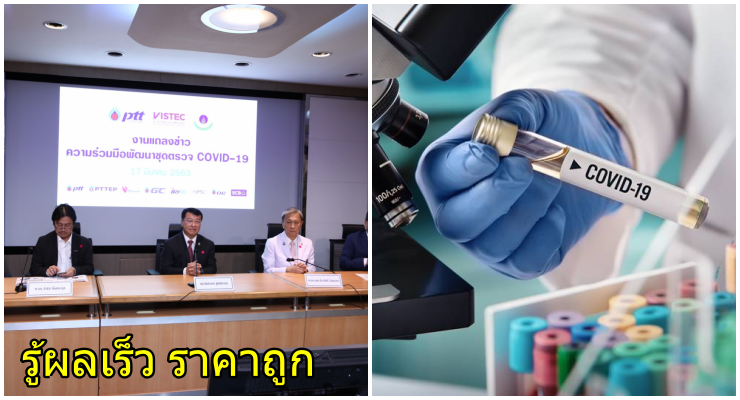 หมอศิริราช อัปเดตชุดตรวจโควิด-19 ราคาไม่ถึง 500- แม่นยำสูง เตรียมรับมือระบาดระยะ 3 - WORLD OF BUZZ