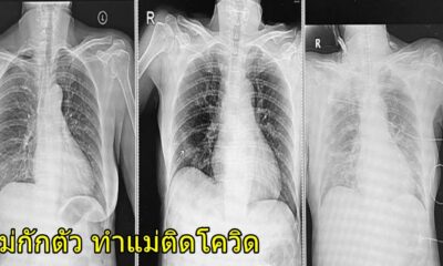 สุดช็อก! ลูกสาวกลับจากต่างประเทศ “ไม่กักตัว” ทำแม่ติดเชื้อระบบหายใจล้มเหลว ต้องเข้า ICU - WORLD OF BUZZ