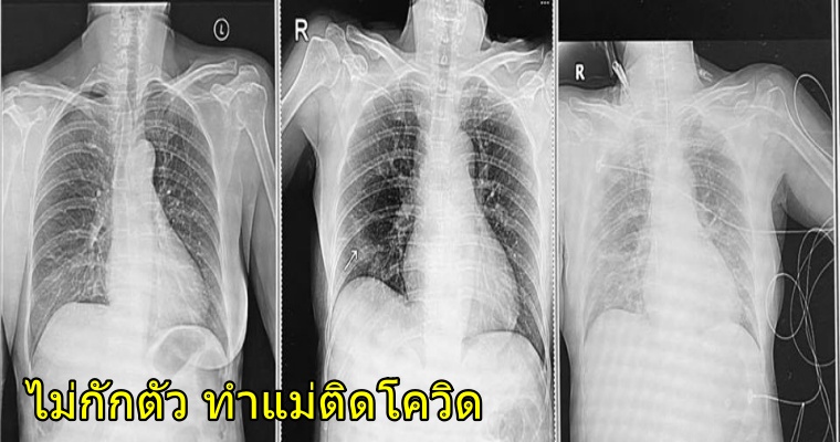 สุดช็อก! ลูกสาวกลับจากต่างประเทศ “ไม่กักตัว” ทำแม่ติดเชื้อระบบหายใจล้มเหลว ต้องเข้า ICU - WORLD OF BUZZ