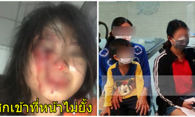 สุดสงสาร! สาวโพสต์ภาพถูกสามีทำร้ายเลือดอาบหน้า เหตุมาจากแม่สามีไล่พ้นบ้าน-แย่งลูก - WORLD OF BUZZ