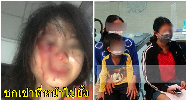 สุดสงสาร! สาวโพสต์ภาพถูกสามีทำร้ายเลือดอาบหน้า เหตุมาจากแม่สามีไล่พ้นบ้าน-แย่งลูก - WORLD OF BUZZ