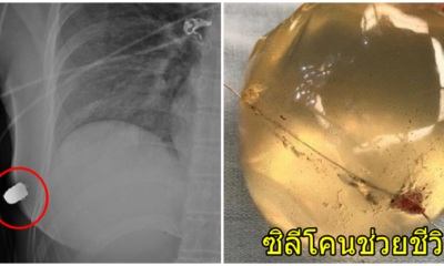 ซิลีโคน