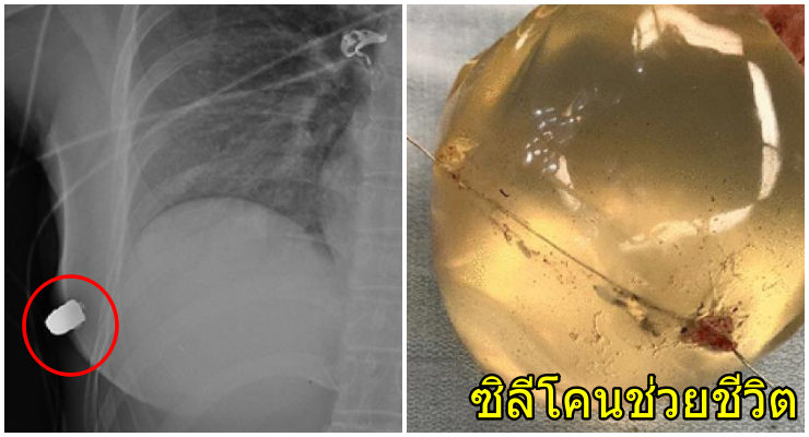 ซิลีโคน