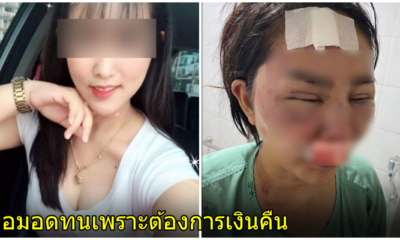 ถูกซ้อม