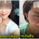ถูกซ้อม