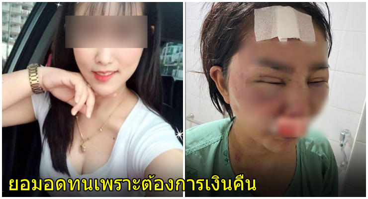 ถูกซ้อม