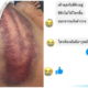 ตี