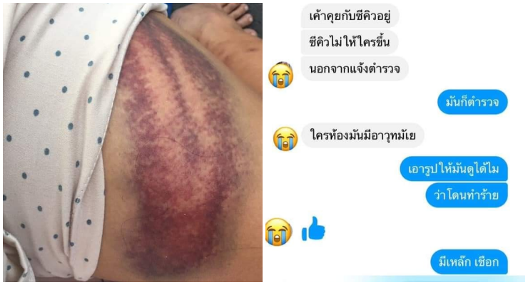 ตี