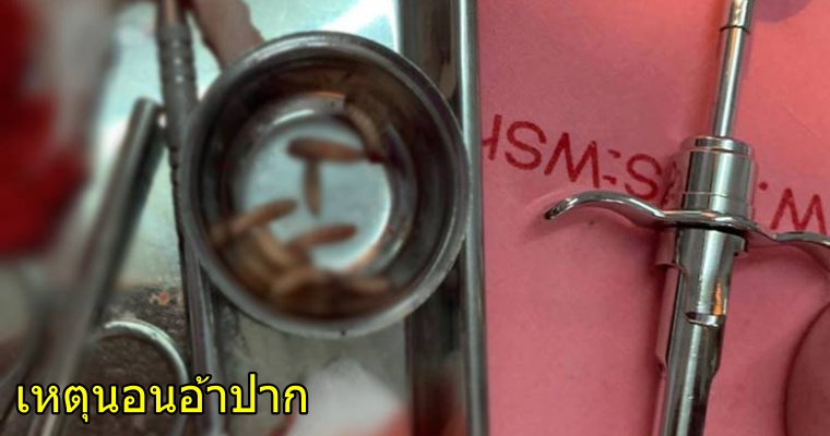 หนอน