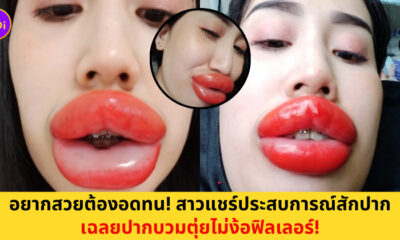 สักปาก ปากบวม
