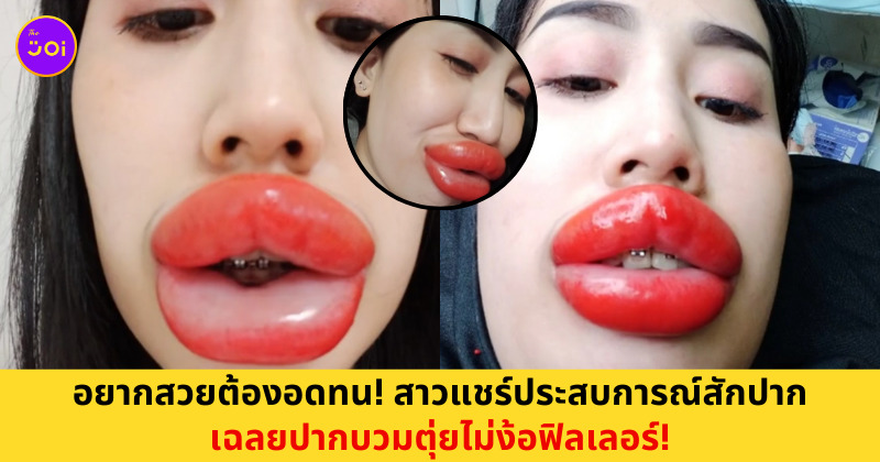 สักปาก ปากบวม