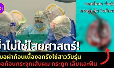 ก้อน
