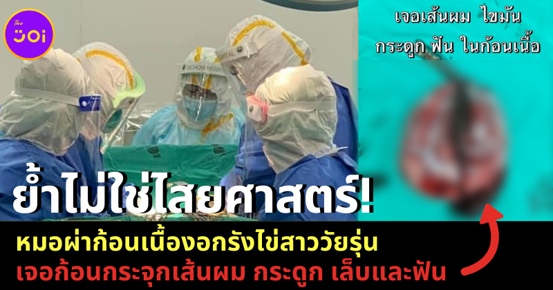 ก้อน