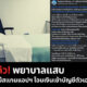 พยาบาลแสบ