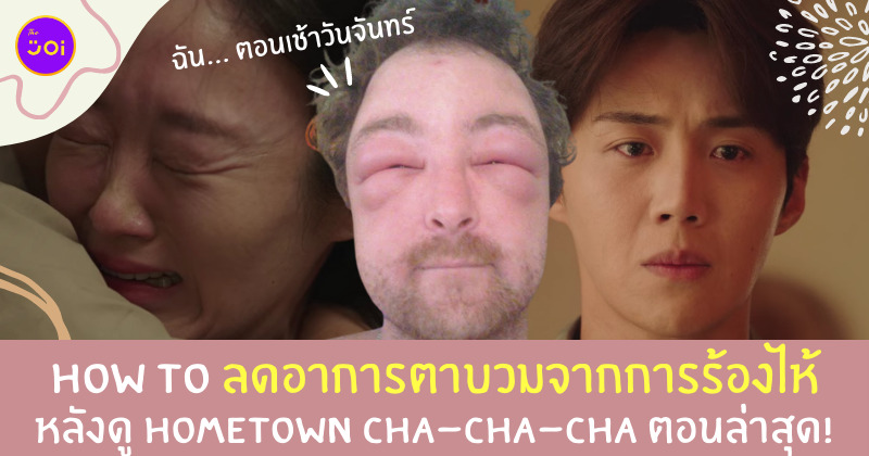 วิธีลดตาบวม