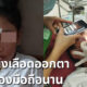 เด็กหญิงเลือดออกตา หลังจ้องมือถือนาน