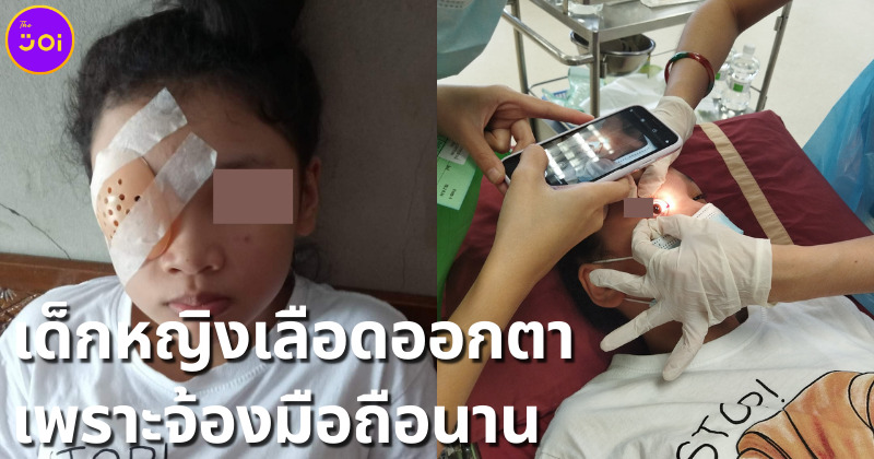 เด็กหญิงเลือดออกตา หลังจ้องมือถือนาน