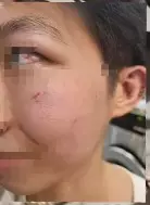 สาวเจ้าของร้านโดนต่อย