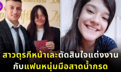 สาวตุรกีหน้าแต่งงานกับแฟนหนุ่มมือสาดน้ำกรด 2