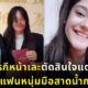 สาวตุรกีหน้าแต่งงานกับแฟนหนุ่มมือสาดน้ำกรด 2